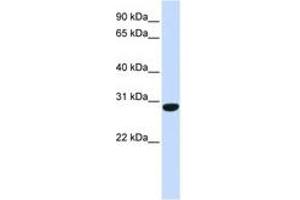 Image no. 1 for anti-Protein FAM164B (ZC2HC1B) (C-Term) antibody (ABIN6741093) (FAM164B Antikörper  (C-Term))
