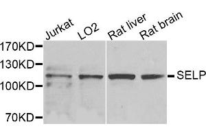 Western blot analysis of extracts of various cells, using SELP antibody. (P-Selectin Antikörper)