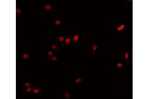 ABIN6266740 staining HeLa cells by IF/ICC. (Tspan-8 Antikörper  (Internal Region))