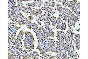IHC analysis of GLIS1 using anti-GLIS1 antibody (ABIN7599501). (GLIS1 Antikörper  (AA 1-620))
