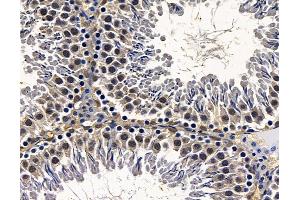 ABIN7095083 and ABIN7099139 at 1/100 staining rat testis tissue by IHC-P. (SRRT Antikörper)