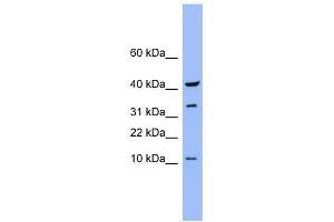 CASP6 antibody used at 0. (Caspase 6 Antikörper  (Middle Region))
