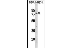 Western blot analysis of RANBP9 Antibody (Center) (ABIN652440 and ABIN2842299) in MDA-M cell line lysates (35 μg/lane). (Importin 9 Antikörper  (AA 339-367))