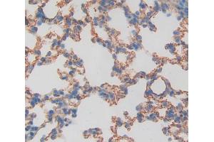 IHC-P analysis of lung tissue, with DAB staining. (TIE1 Antikörper  (AA 435-609))