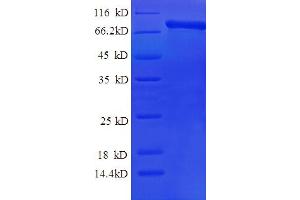 SDS-PAGE (SDS) image for Calpain 2 (CAPN2) (AA 20-700) protein (His tag) (ABIN5709191)