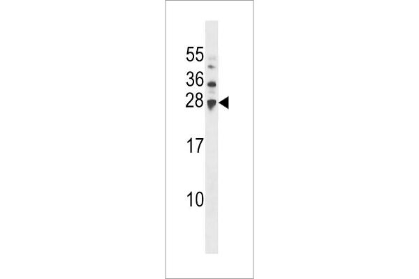 UBE2H Antikörper  (AA 42-70)