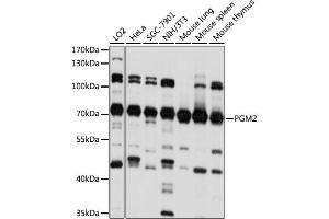 Western blot analysis of extracts of various cell lines, using PGM2 antibody. (Phosphoglucomutase 2 Antikörper)