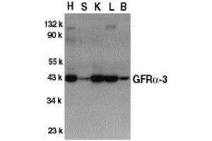 Western blot analysis of GFR alpha 3 in crude cell membrane fractions of mouse heart (H), spleen (S), kidney (K), liver (L), and brain (B), respectively, with AP30363PU-N GFR alpha 3 antibody at 1/500 dilution.