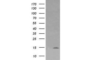 Image no. 1 for anti-Lysozyme (LYZ) antibody (ABIN1499236) (LYZ Antikörper)