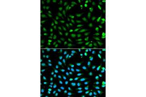 Immunofluorescence analysis of A549 cell using PCNA antibody. (PCNA Antikörper  (AA 1-261))