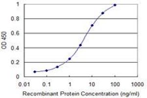 Detection limit for recombinant GST tagged SIRT1 is 0. (SIRT1 Antikörper  (AA 456-555))