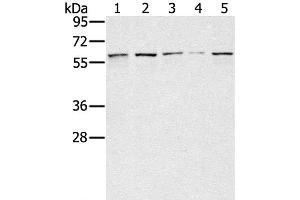 Western Blot analysis of Lovo, hela, K562, Raji and hepg2 cell using SESN1 Polyclonal Antibody at dilution of 1:200 (SESN1 Antikörper)