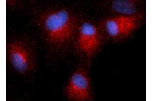 Immunofluorescence (IF) image for anti-Centromere Protein B (CENPB) antibody (PE) (ABIN5567026)
