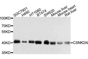 Western blot analysis of extracts of various cells, using CSNK2A1 antibody. (CSNK2A1/CK II alpha Antikörper)