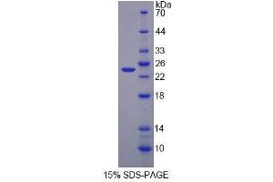 SDS-PAGE analysis of Human AGXT Protein.