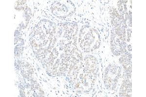 Immunohistochemistry (IHC) image for anti-H2A Histone Family, Member X (H2AFX) (C-Term) antibody (ABIN7449409)
