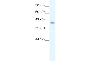 WB Suggested Anti-CATSPER2 Antibody Titration:  1. (CATSPER2 Antikörper  (N-Term))