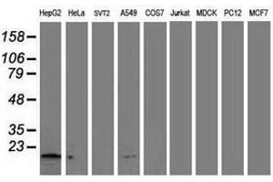 Image no. 2 for anti-NADH Dehydrogenase (Ubiquinone) 1 alpha Subcomplex, 7, 14.5kDa (NDUFA7) antibody (ABIN1499660) (NDUFA7 Antikörper)
