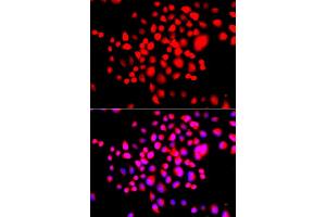 Immunofluorescence analysis of A549 cells using STK19 antibody. (STK19 Antikörper)