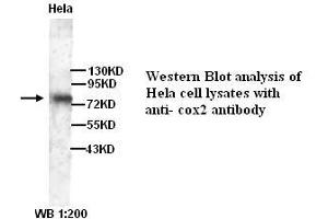 Image no. 1 for anti-Prostaglandin-Endoperoxide Synthase 2 (Prostaglandin G/H Synthase and Cyclooxygenase) (PTGS2) antibody (ABIN790887) (PTGS2 Antikörper)
