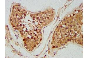 IHC image of ABIN7161183 diluted at 1:300 and staining in paraffin-embedded human testis tissue performed on a Leica BondTM system. (UNC5B Antikörper  (AA 404-517))