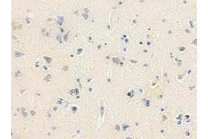 anti-Acidic (Leucine-Rich) Nuclear Phosphoprotein 32 Family, Member D (ANP32D) (N-Term) antibody