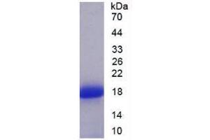 SDS-PAGE analysis of Human SFRP5 Protein. (SFRP5 Protein)