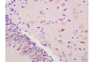 Immunohistochemistry (IHC) image for anti-Solute Carrier Organic Anion Transporter Family, Member 2A1 (SLCO2A1) (AA 611-643) antibody (ABIN1386754)