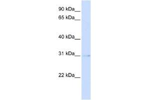 PVRIG antibody used at 1 ug/ml to detect target protein. (PVRIG Antikörper  (Middle Region))