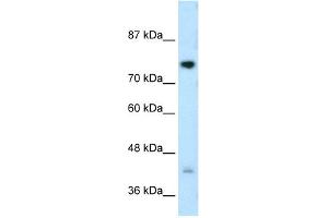 WB Suggested Anti-DCST1 Antibody Titration:  0.