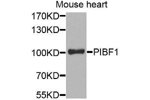 Western blot analysis of extracts of mouse heart, using PIBF1 antibody. (PIBF1 Antikörper)