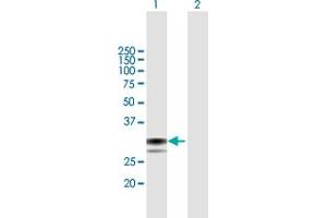 Western Blot analysis of SPSB1 expression in transfected 293T cell line by SPSB1 MaxPab polyclonal antibody. (SPSB1 Antikörper  (AA 1-273))