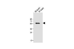 All lanes : Anti-CK2D (CK2 delta) Antibody (C-term) at 1:1000 dilution Lane 1: Mouse brain tissue lysate Lane 2: Rat brain tissue lysate Lysates/proteins at 20 μg per lane. (CAMK2D Antikörper  (C-Term))
