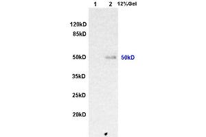 L1 rat kidney lysates L2 human colon carcinoma lysates probed with Anti ILK-1 Polyclonal Antibody, Unconjugated (ABIN727800) at 1:200 overnight at 4 °C. (ILK Antikörper  (AA 301-400))