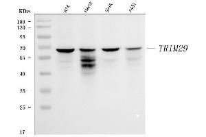 Western blot analysis of TRIM29 using anti-TRIM29 antibody (ABIN7600245).