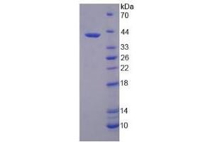 Image no. 1 for S-Phase Kinase-Associated Protein 2 (SKP2) (AA 43-397) protein (His tag) (ABIN6237815)