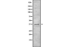 Western blot analysis of TAS2R40 using 293 whole cell lysates (TAS2R40 Antikörper  (Internal Region))