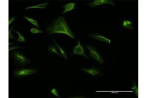 Immunofluorescence of monoclonal antibody to ATF6B on HeLa cell. (ATF6B Antikörper  (AA 2-88))