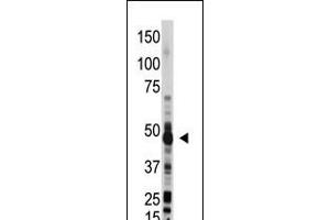 Antibody is used in Western blot to detect OAS1 in mouse liver lysate. (OAS1 Antikörper  (C-Term))