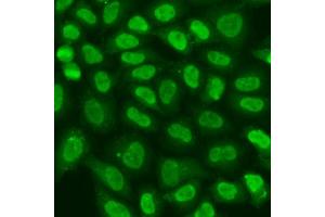 Immunofluorescence analysis of U2OS cells using TERF2IP antibody (ABIN6293618) at dilution of 1:100. (RAP1 Antikörper)
