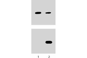 Human Endothelial cells were either untreated (left column) or treated with (right column) IL-4 (10 ng/ml) for 1 hour at 37°C.