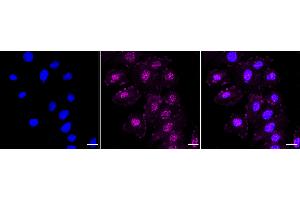 Immunocytochemical staining of H9C2 cells with Phospho-PAK4 + PAK5 + PAK6 (S474 + S560 + S602) antibody (ABIN7799729), 1:1,000). (Rekombinanter PAK4/PAK5/PAK6 (pSer474), (pSer560), (pSer602) Antikörper)