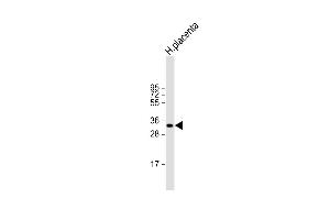Anti-HPGD Antibody (C-term) at 1:2000 dilution + human placenta lysate Lysates/proteins at 20 μg per lane.