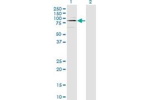 Western Blot analysis of ODF2 expression in transfected 293T cell line by ODF2 monoclonal antibody (M01), clone 1A1. (ODF2 Antikörper  (AA 706-804))