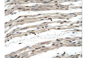 SIL1 antibody was used for immunohistochemistry at a concentration of 4-8 ug/ml. (SIL1 Antikörper)