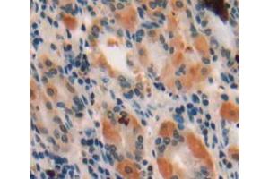 Used in DAB staining on fromalin fixed paraffin-embedded stomach tissue (WISP1 Antikörper  (AA 216-347))