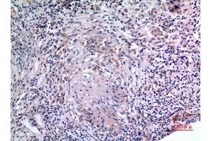 Immunohistochemistry (IHC) analysis of paraffin-embedded Human Lung, antibody was diluted at 1:100. (IL-6 Antikörper  (Internal Region))