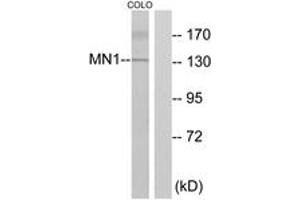 Western Blotting (WB) image for anti-MN1 proto-oncogene (MN1) (AA 821-870) antibody (ABIN2889560) (Meningioma 1 Antikörper  (AA 821-870))