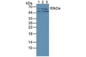 Western blot analysis of (1) Human PC-3 Cells, (2) Human Liver Tissue and (3) Mouse Kidney Tissue. (RORA Antikörper  (AA 164-401))