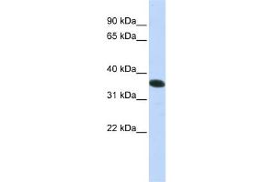 WB Suggested Anti-C21orf59 Antibody Titration:  0. (C21orf59 Antikörper  (N-Term))